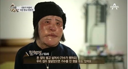 한국 성형 실패 “선풍기 아줌마”, 젊을 때 미인사진 공개