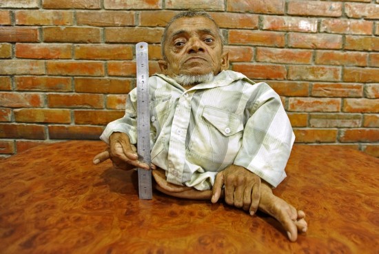 네팔로인 키 40.6센치메터, “세계에서 가장 작은 남자”로 유망