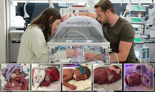 다섯쌍둥이 탄생 1969년 이후 세계최초