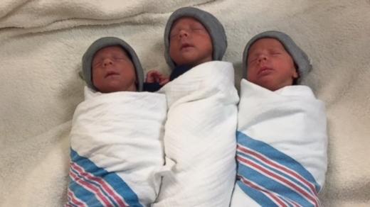확률 200만분의 1… 미국서 '일란성 세쌍둥이' 탄생